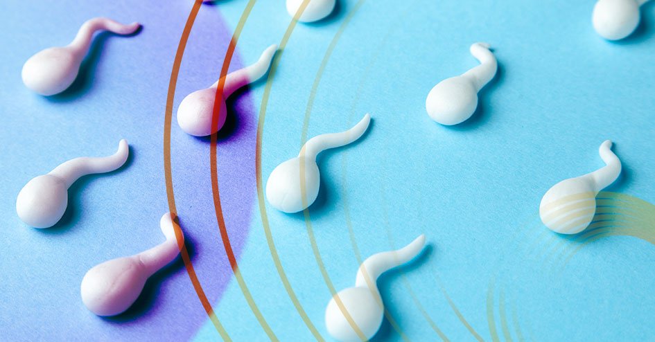 Capa Varicocele Capa Varicocele